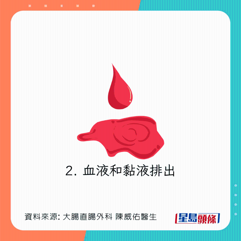 直腸脫垂(脫肛)癥狀