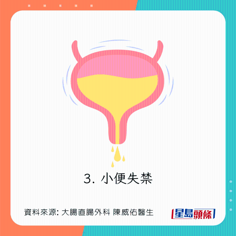 直腸脫垂(脫肛)癥狀