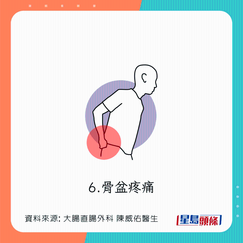 直腸脫垂(脫肛)癥狀