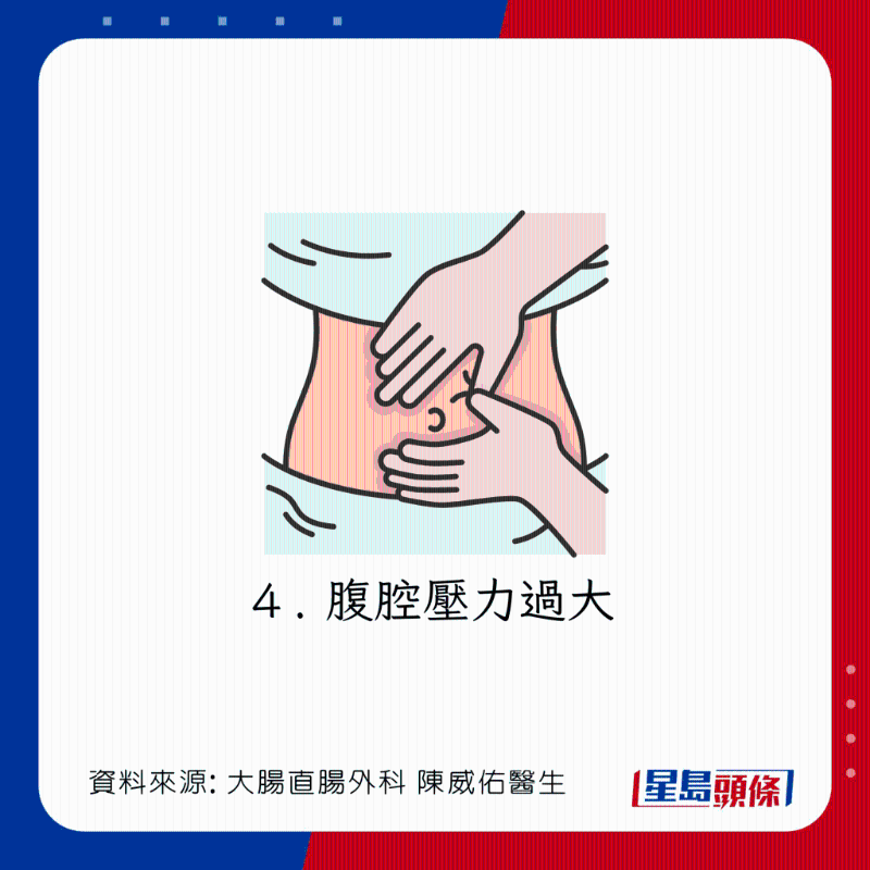 直腸脫垂(脫肛)成因