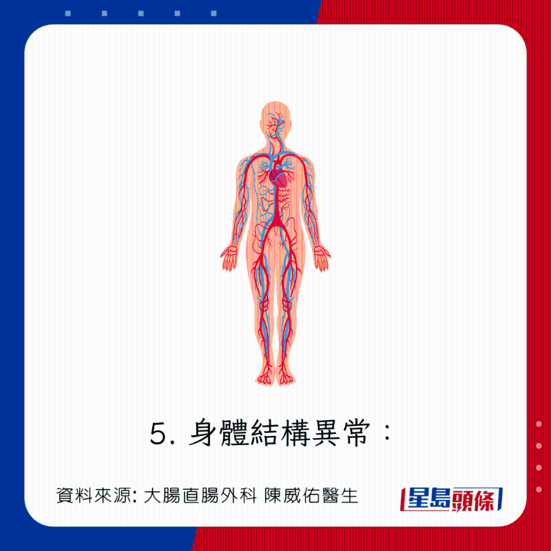 直腸脫垂(脫肛)成因