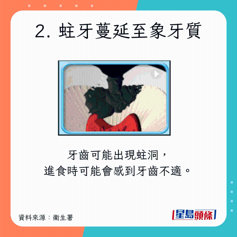 蛀牙癥狀及治療方法