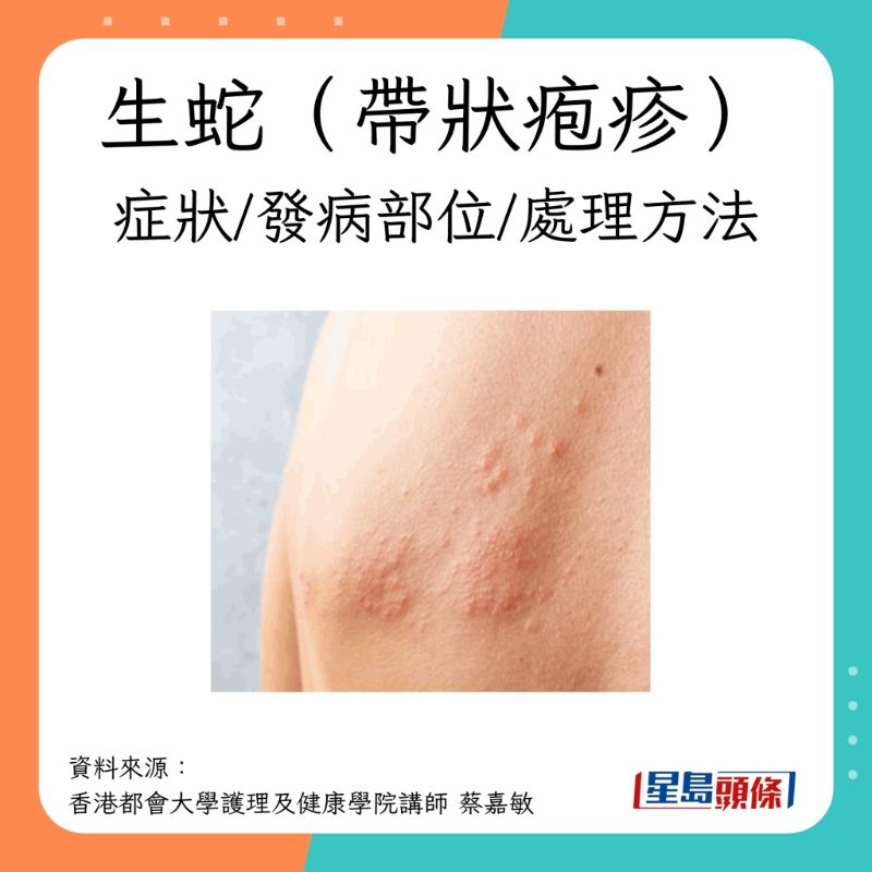 癥狀