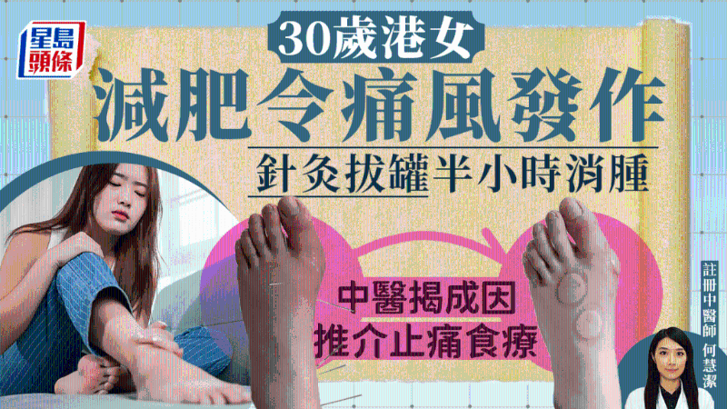 港女減肥引發(fā)痛風(fēng)，中醫(yī)治療30分鐘消腫，揭4方法預(yù)防痛風(fēng)