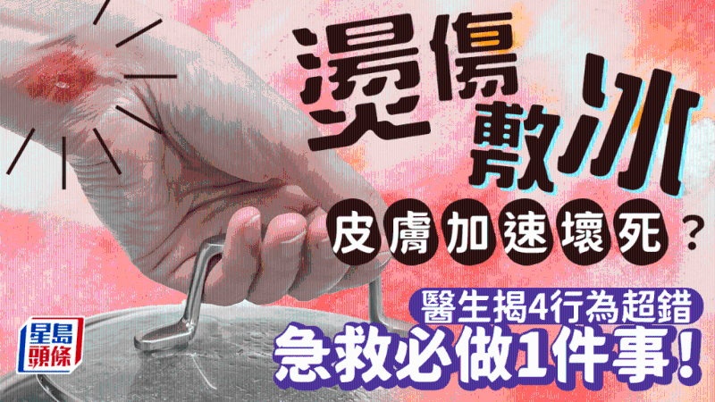 燙傷立即敷冰超錯