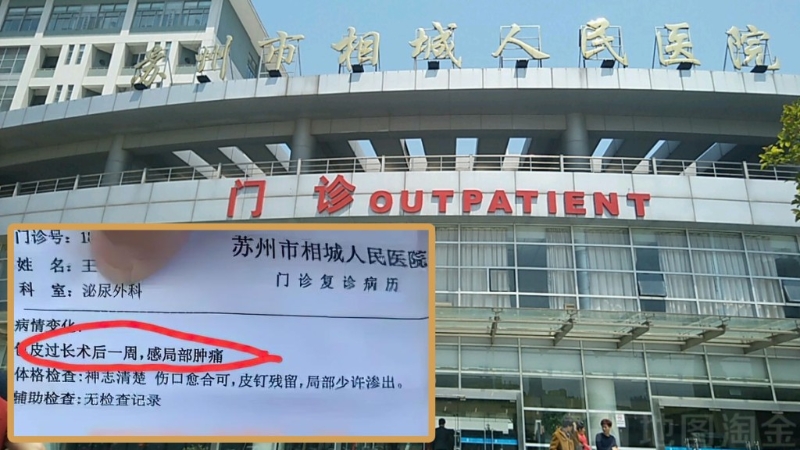 江蘇蘇州市相城人民醫(yī)院擺大烏龍，女病人竟被診斷包皮過長。