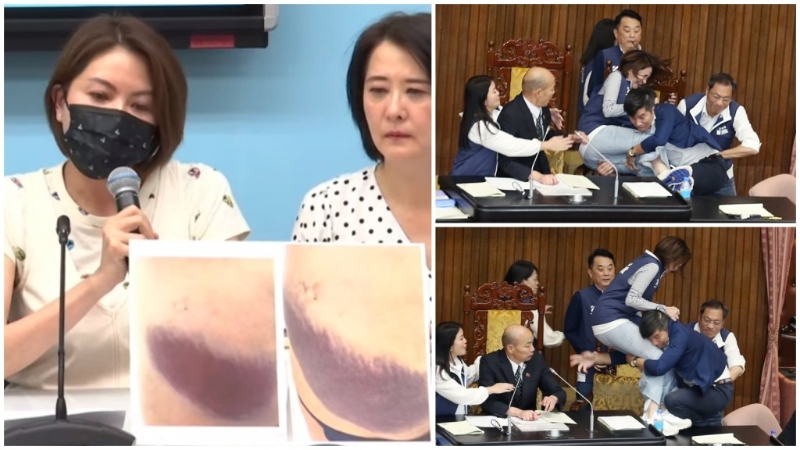 女議員陳菁徽（左）在記者會上公開照片，指受傷不輕。　臺灣中時新聞網(wǎng)