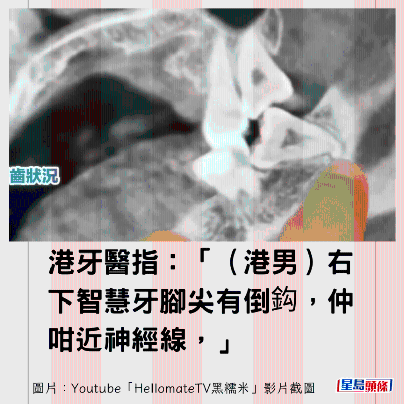 港牙醫(yī)指深圳牙醫(yī)犯三大錯(cuò)12