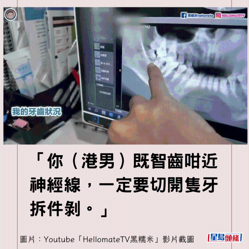 港牙醫(yī)指深圳牙醫(yī)犯三大錯(cuò)9
