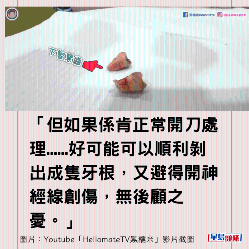 港牙醫(yī)指深圳牙醫(yī)犯三大錯(cuò)6