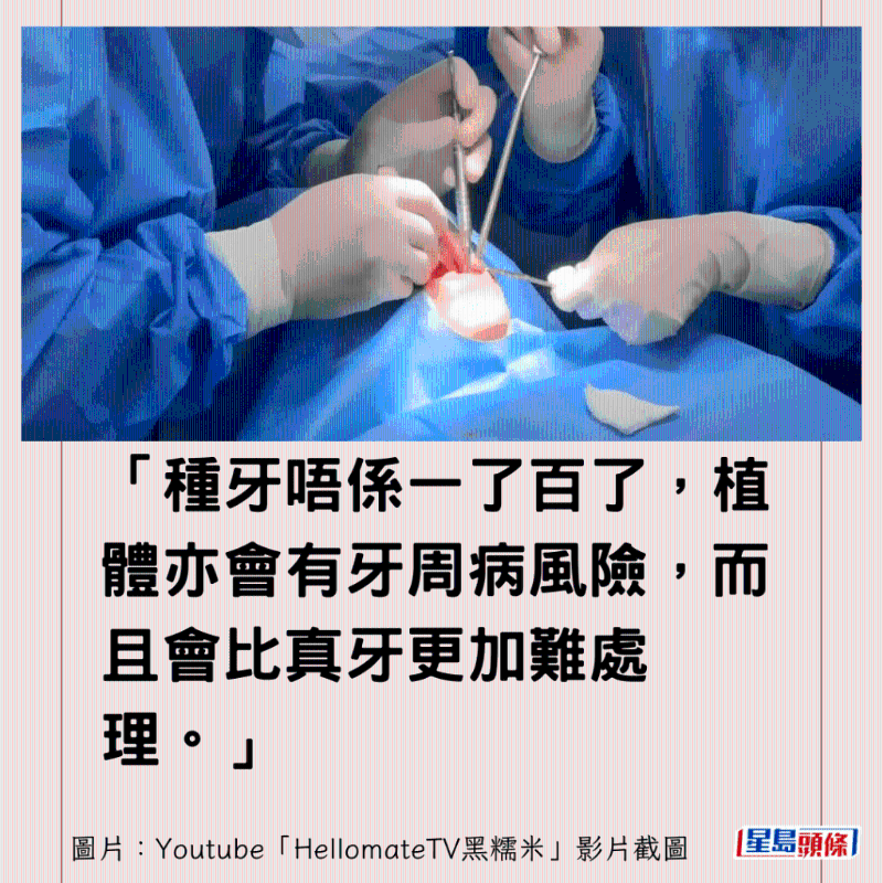 港牙醫(yī)指深圳牙醫(yī)犯三大錯(cuò)3