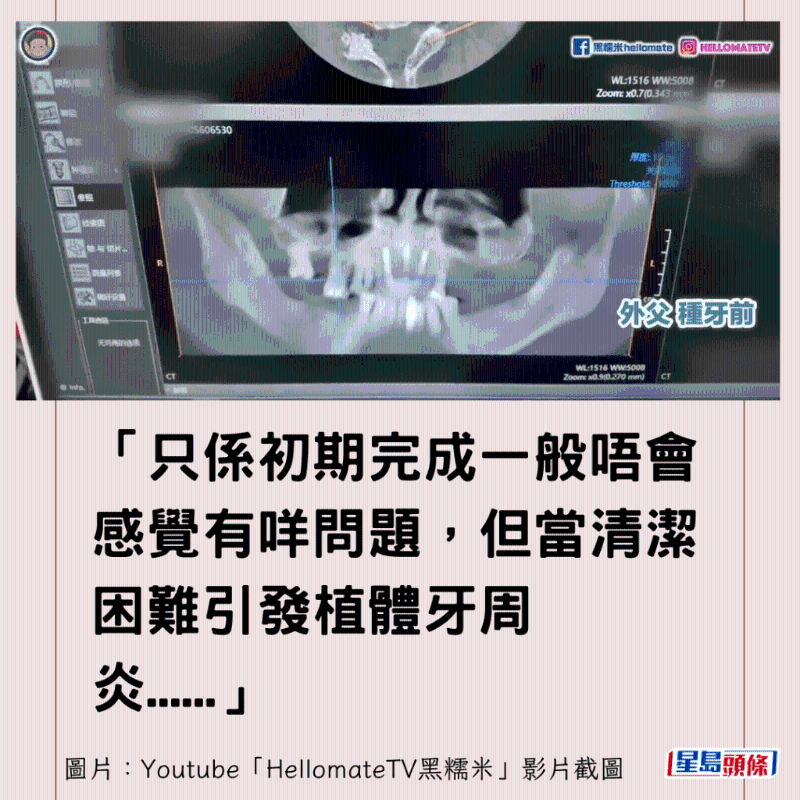 港牙醫(yī)指深圳牙醫(yī)犯三大錯(cuò)2