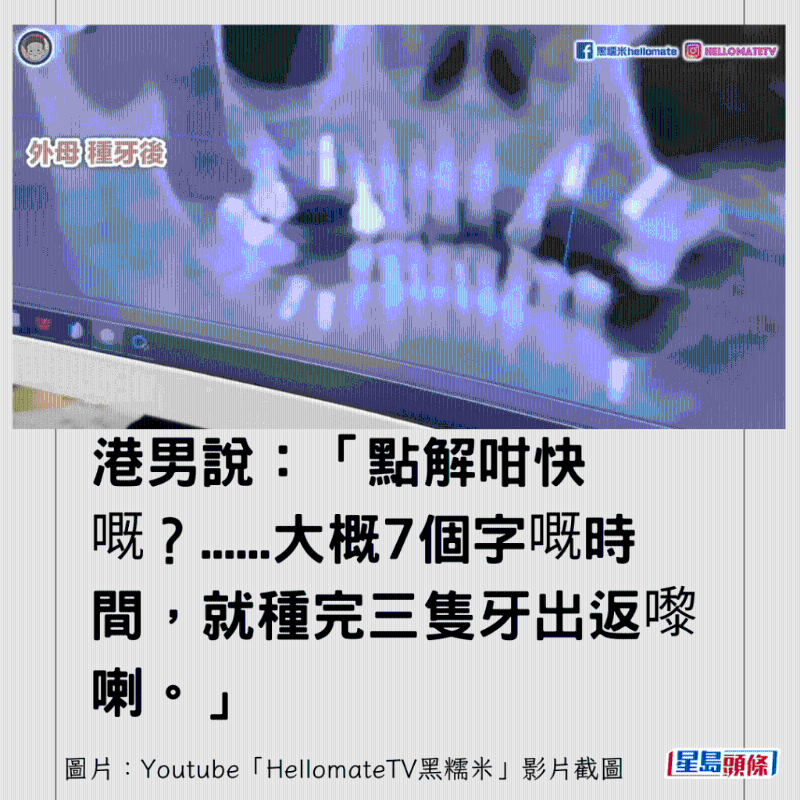 香港男子實(shí)測(cè)深圳平價(jià)洗牙種牙8