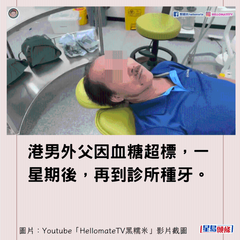 香港男子實(shí)測(cè)深圳平價(jià)洗牙種牙6