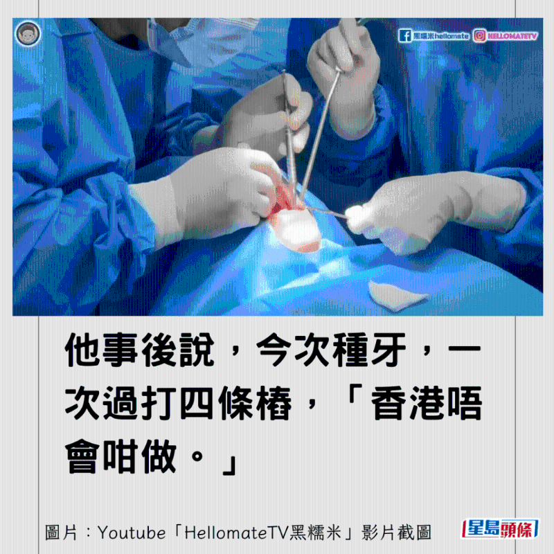 香港男子實(shí)測(cè)深圳平價(jià)洗牙種牙4