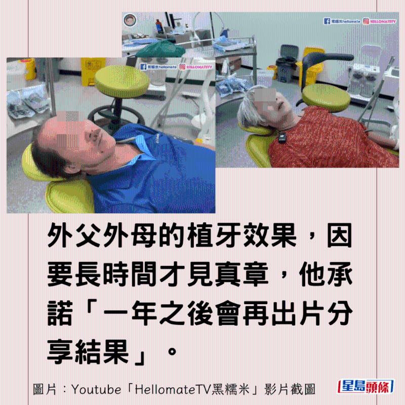 香港男子實(shí)測(cè)深圳平價(jià)洗牙種牙2