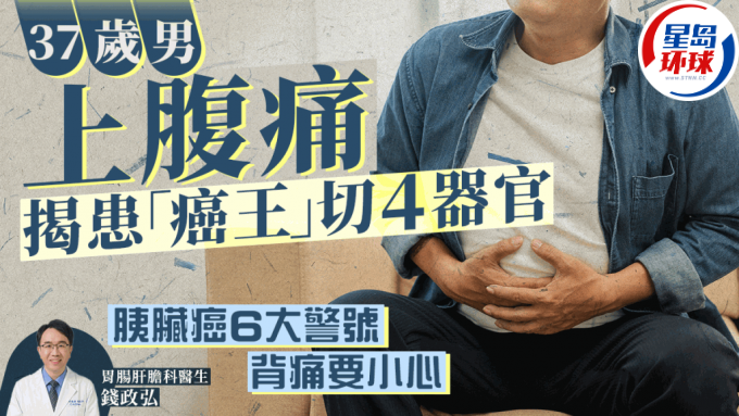 37歲男上腹痛揭患胰臟癌
