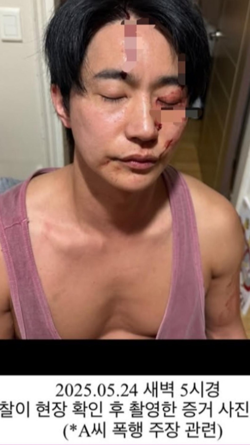 全浩俊曬出鼻青臉腫的照片回應(yīng)。 （TVBS新聞網(wǎng)圖片）