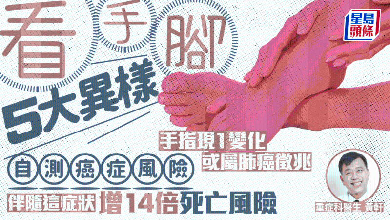 示意圖