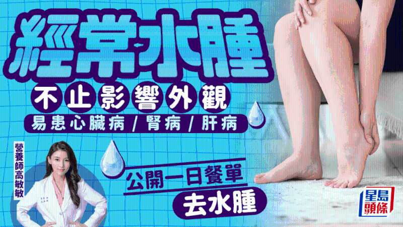 經(jīng)常水腫不止影響外觀 經(jīng)常水腫不止影響外觀